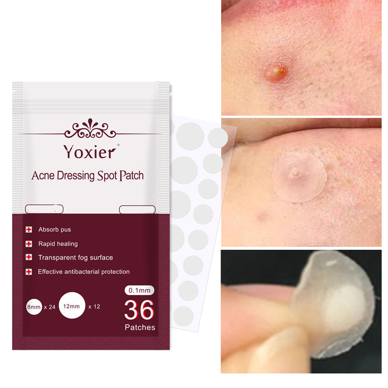 Invisible Acne Patches, 36-Piece Blemish Spot Treatment