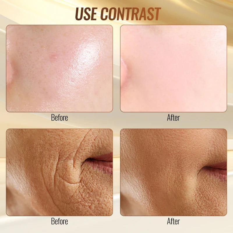 High Frequency Facial Therapy Device