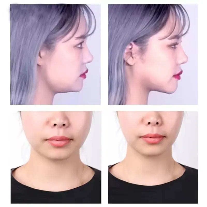 V-Shape Face Lifting Tape