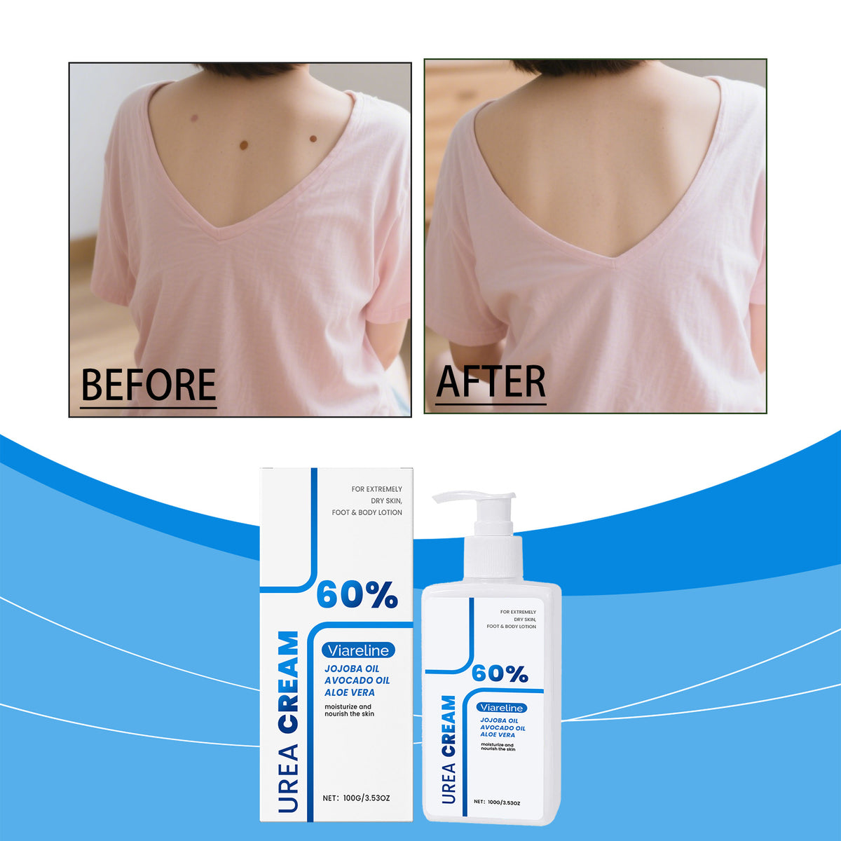 Creme de Ureia para Pés e Corpo